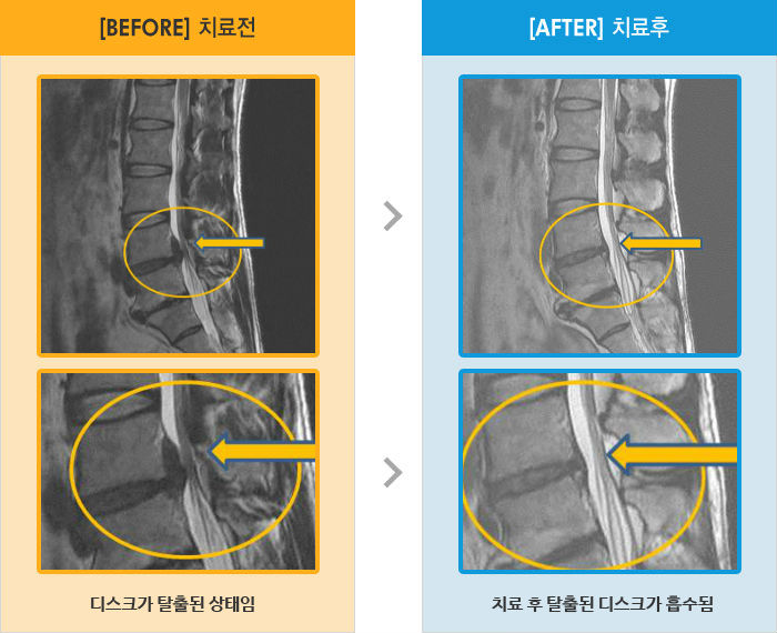 ڻѹ溴 ġ MRI  ġ-㸮 ,   