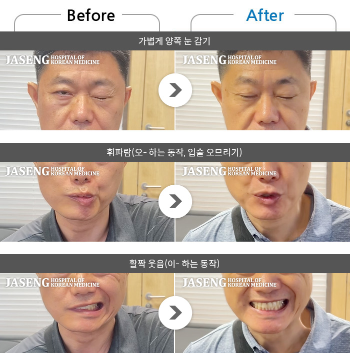 뱸ڻѹ溴 ġ ȸŰ渶 ġ-      ȸ ü  ̴.