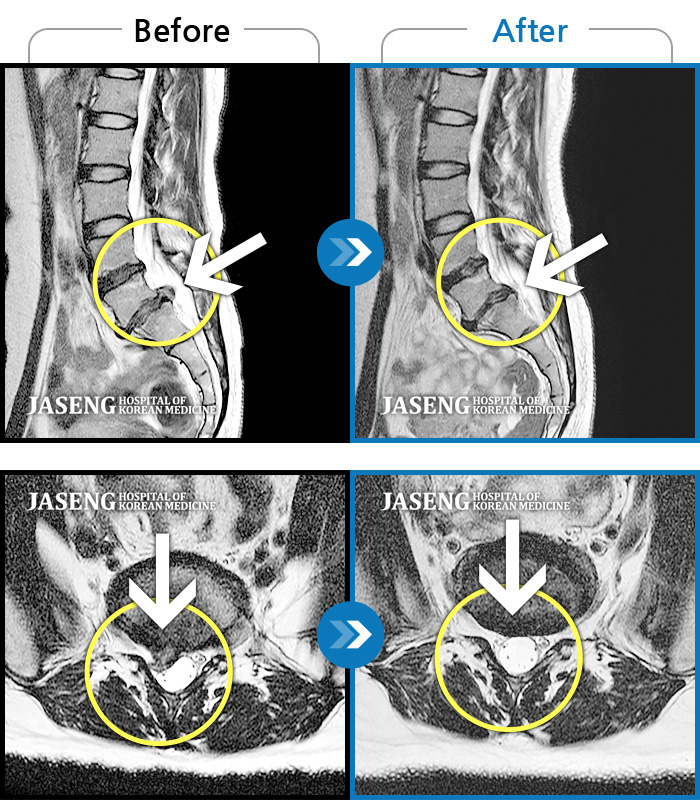 ûڻѹ溴 ġ MRI  ġ-۽    Ұϰ  ϴ ·  