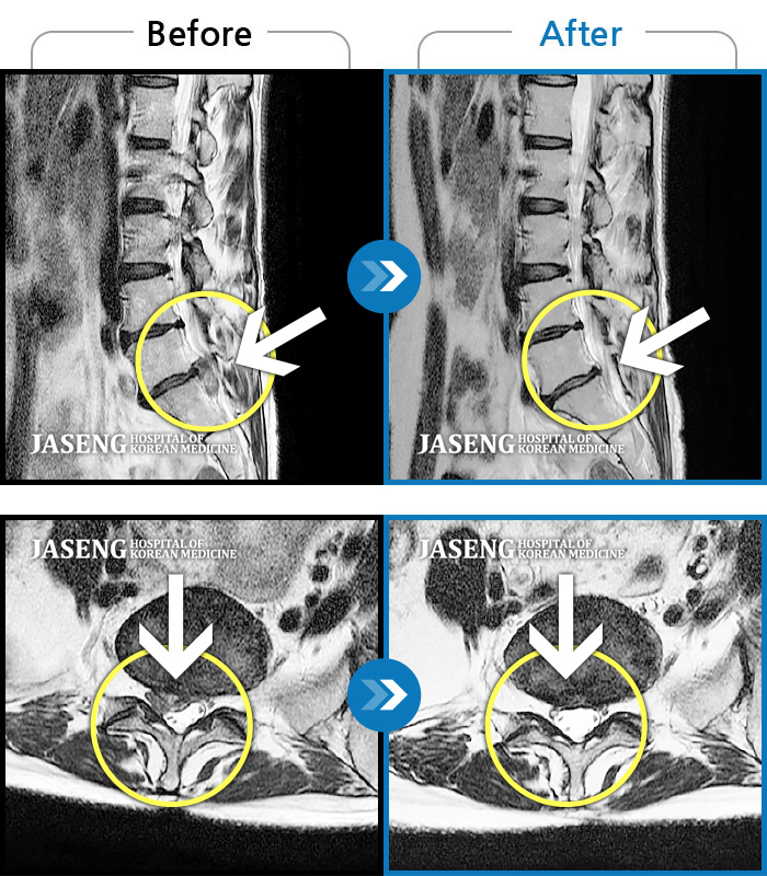 ûڻѹ溴 ġ MRI  ġ-߳  ӵǰ, ɰų      