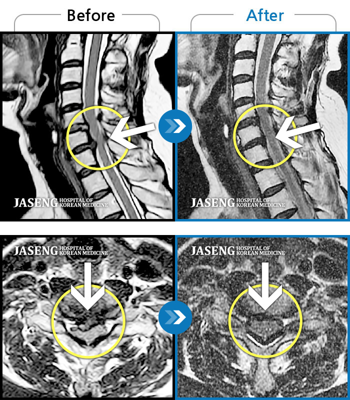 ڻѹ溴 ġ MRI  ġ-߰    İ  ¸ ؽ 