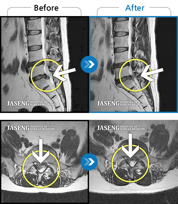 ڻѹ溴 ġ MRI  ġ-㸮,  ġ ٸ ĸ  ߳   ϰ  .