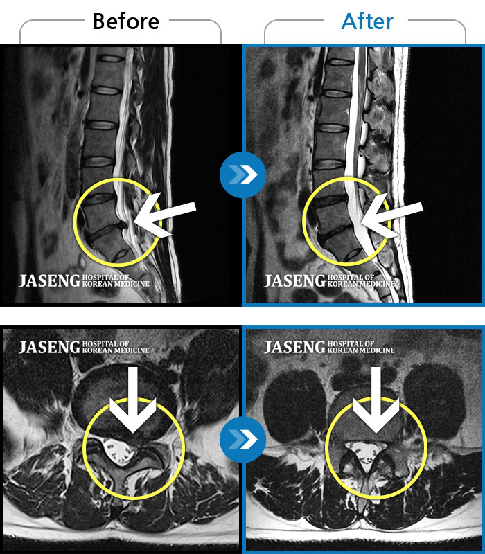 дڻѹ溴 ġ MRI  ġ-̵  ýÿ  Ͻô ȯںԴϴ