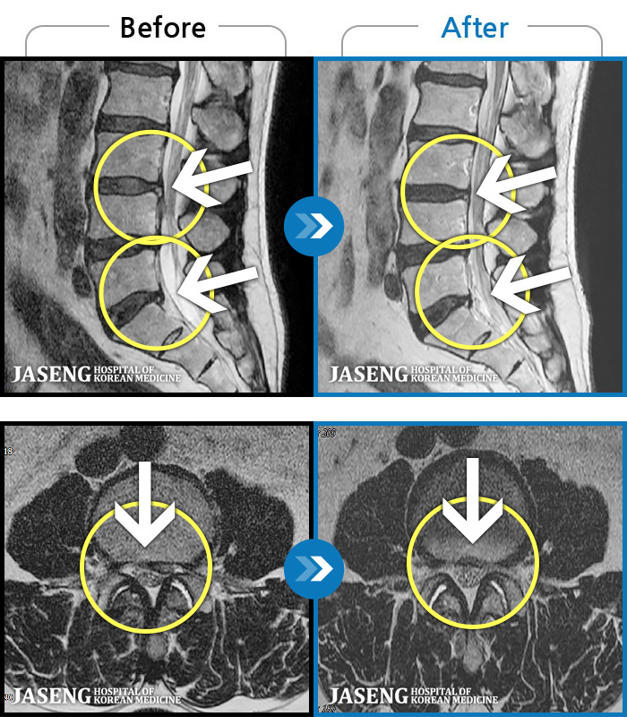 ڻѹ溴 ġ MRI  ġ- 㸮     Ͽ ȴ ͵  · ϼ̽ϴ. 