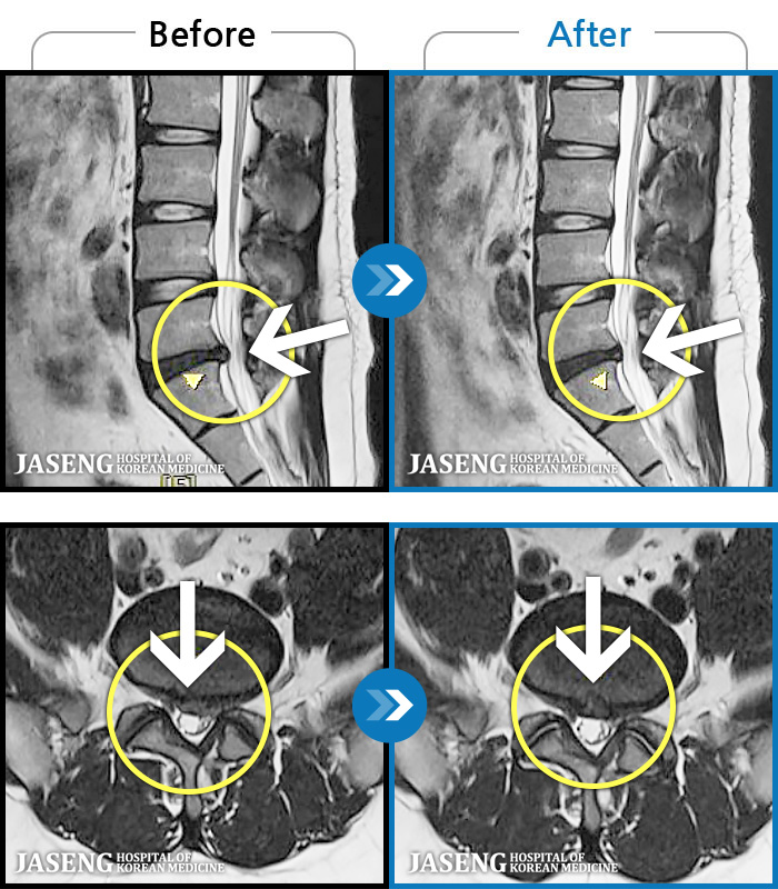 ڻѹ溴 ġ MRI  ġ- 㸮    ݵǴ  ְ, ɰų    ȭǾ ϼ̽ϴ.