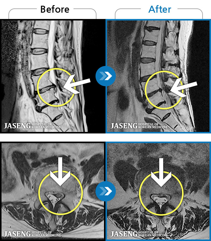 ڻѹ溴 ġ MRI  ġ-㸮,  ݺ  ٸ    ӵǰ  ٸ  