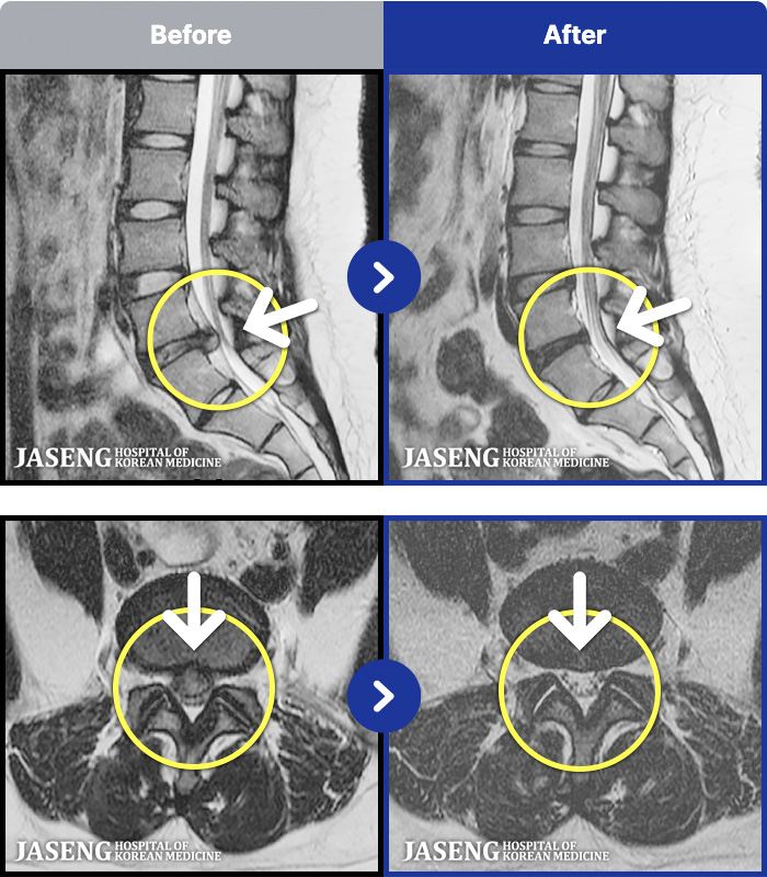 �ڻ��ѹ溴�� ġ���� MRI�� ���� ġ����-���� �� ���� ��������� ȣ���Ͽ� ���� �� ���������� ��ũ�� ������